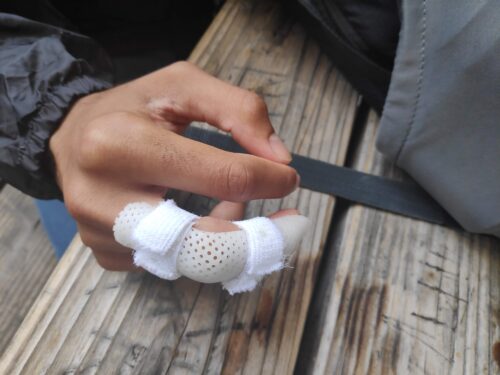 Impressão em resina 3D aplicação médica